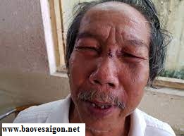bao ve danh khach bi thuong do mau thuan dau xe